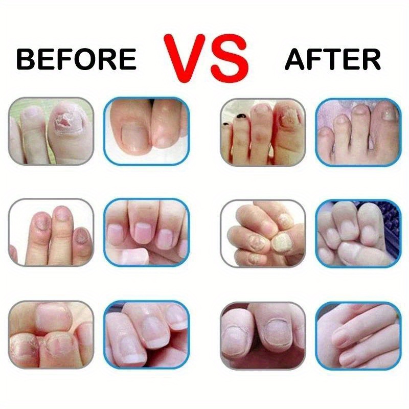 Nail Nutrition Oil Pen Nail Tr - Cuticle Oil Pen ulasan dan harga